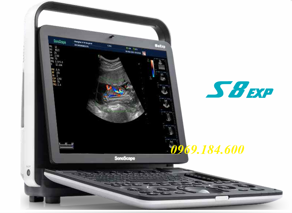 Máy siêu âm 2D SonoScape S8 Exp